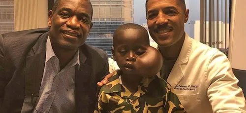 Congo : atteint d'une tumeur au visage, il se fait opérer aux USA