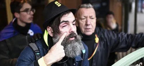 Gilets jaunes : mise en examen du policier qui a éborgné Jérôme...