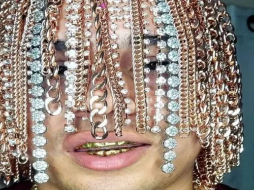 Un rappeur mexicain se fait implanter des chaines en or sur la tête