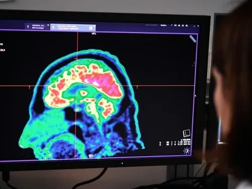 Nouvelle avancée : les ultrasons contre la dépression 