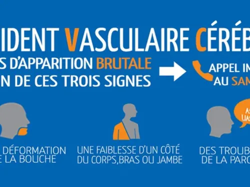 Les accidents vasculaires cérébraux touchent toujours des habitants...