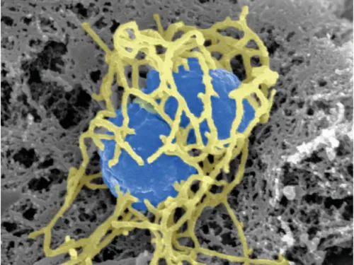 Presque une dizaine d'infections par méningocoques l'an dernier...