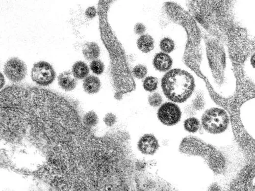 La présence d'un virus extrêmement rare confirmée en Île-de-France