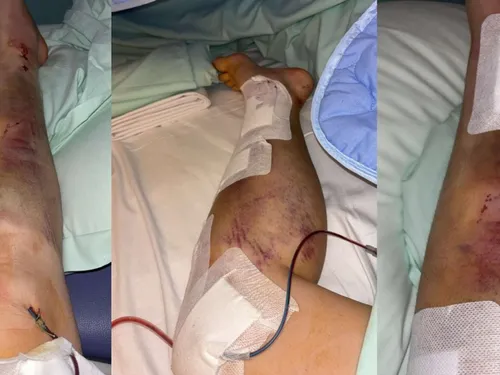 Fourmies : appel à témoins après un accident avec délit de fuite