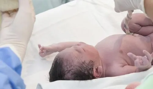 Un petit garçon naît avec trois pénis en Irak, une première mondiale