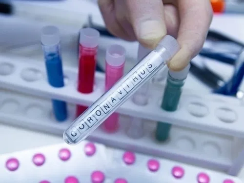 Coronavirus : Selon le conseil scientifique, l’épidémie pourrait...