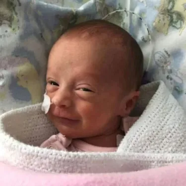 En Écosse, un bébé prématuré a réussi à guérir du coronavirus