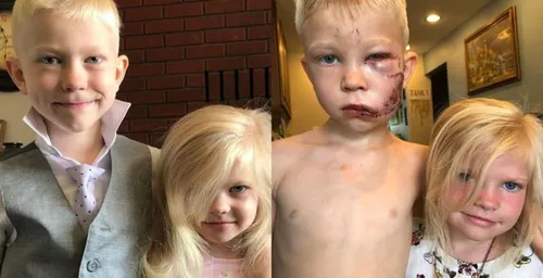 Un petit garçon de 6 ans risque sa vie pour sauver sa petite sœur...