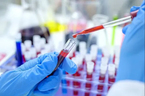 Un test sanguin capable de détecter le cancer quatre ans avant son...