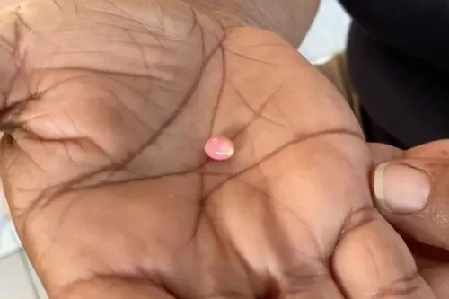 Une guadeloupéenne trouve une perle rose, extrêmement rare, en...