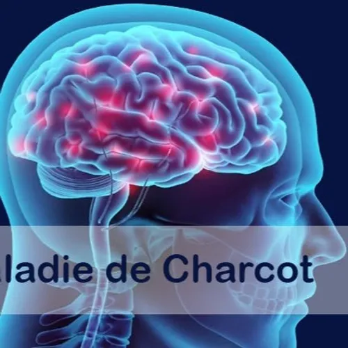 [ Santé ] Et si les premiers signes de la maladie de Charcot...