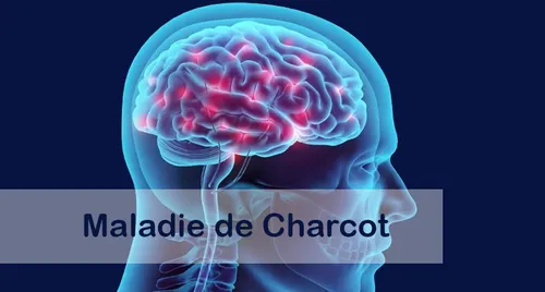[ Santé ] Et si les premiers signes de la maladie de Charcot...
