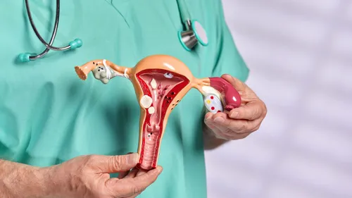 [ Santé ] Endométriose : Une femme sur dix en France concernée