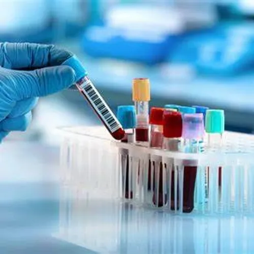 [ Santé / Société ] Laboratoires d’analyses médicales : en grève...