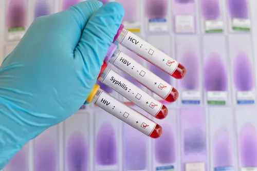 [ SANTE - FRANCE ] Le dépistage des infections sexuellement...
