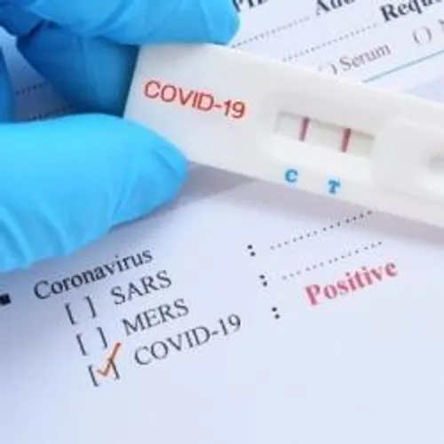 [COVID-19]: 100 mille tests ont été commandés et 11 machines pour...